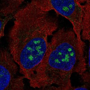 Anti-BLCAP antibody produced in rabbit 