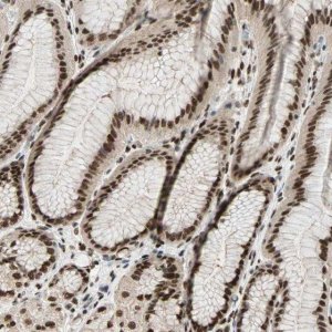Anti-BLM antibody produced in rabbit 