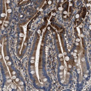 Anti-BLOC1S1 antibody produced in rabbit 