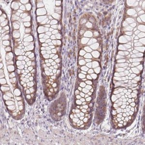 Anti-BLOC1S2 antibody produced in rabbit 
