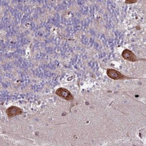 Anti-BLOC1S4 antibody produced in rabbit 