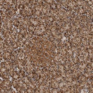 Anti-BMP2K antibody produced in rabbit 