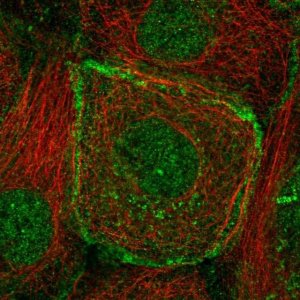 Anti-BMPR2 antibody produced in rabbit 