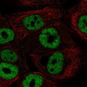 Anti-BNC1 antibody produced in rabbit 
