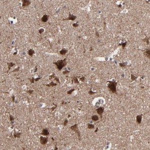 Anti-BNIP3 antibody produced in rabbit 