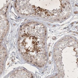 Anti-BOD1 antibody produced in rabbit 