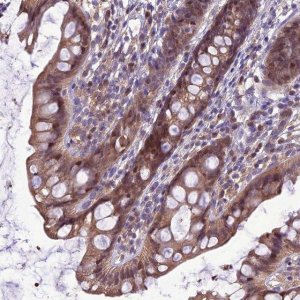 Anti-BORCS6 antibody produced in rabbit 