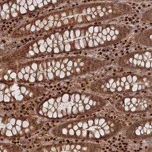 Anti-BORCS7 antibody produced in rabbit 