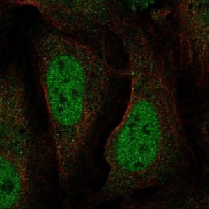 Anti-BRAT1 antibody produced in rabbit 
