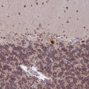 Anti-BRD3 antibody produced in rabbit 