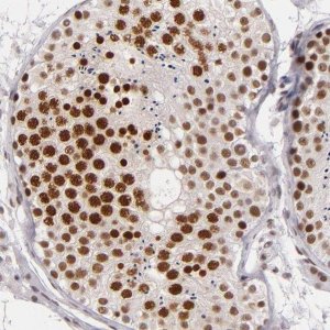 Anti-BRD8 antibody produced in rabbit 