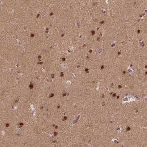Anti-BRD9 antibody produced in rabbit 