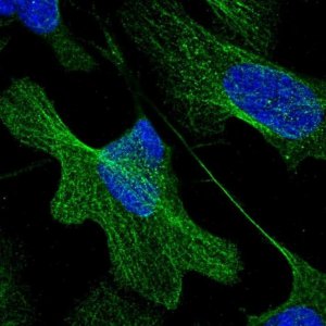 Anti-BRINP1 antibody produced in rabbit 