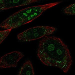 Anti-BRINP2 antibody produced in rabbit 