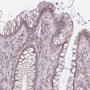 Anti-BRINP3 antibody produced in rabbit 