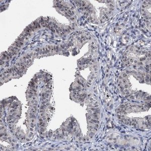 Anti-BRIX1 antibody produced in rabbit 