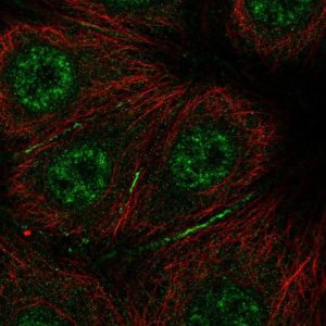 Anti-BRK1 antibody produced in rabbit 