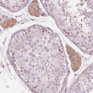 Anti-BRSK1 antibody produced in rabbit 