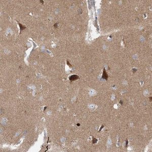 Anti-BRWD1 antibody produced in rabbit HPA030945-100UL