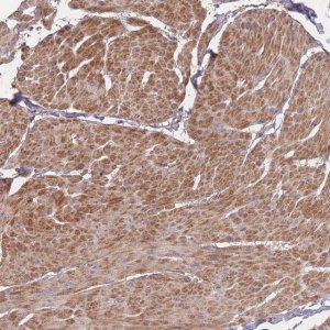 Anti-BST1 antibody produced in rabbit 