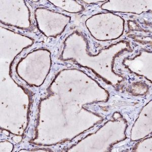 Anti-BTBD16 antibody produced in rabbit 