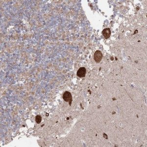 Anti-BTBD18 antibody produced in rabbit 