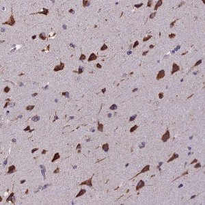 Anti-BTBD3 antibody produced in rabbit 