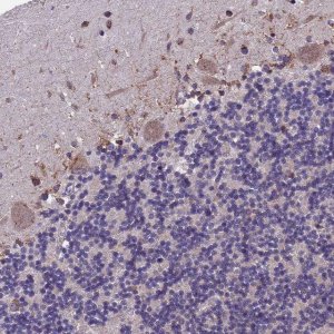 Anti-BTBD3 antibody produced in rabbit 