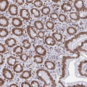 Anti-BTBD7 antibody produced in rabbit 