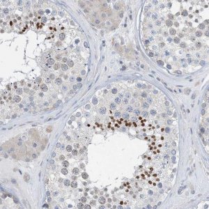 Anti-BTBD8 antibody produced in rabbit 