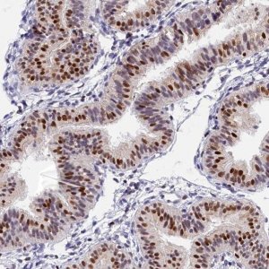 Anti-BTBD9 antibody produced in rabbit 