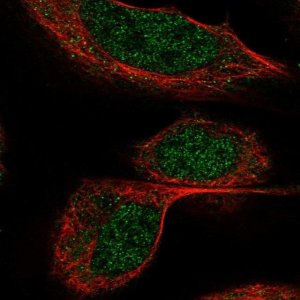 Anti-BTBD9 antibody produced in rabbit 