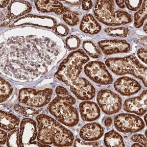 Anti-BTF3 antibody produced in rabbit HPA056420-100UL