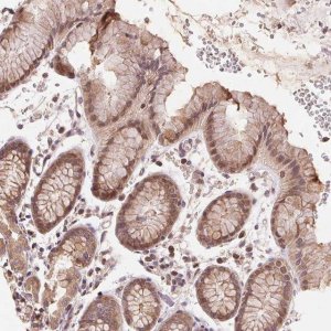 Anti-BTF3L4 antibody produced in rabbit 