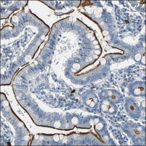 Anti-BTG1 antibody produced in rabbit HPA005972-100UL