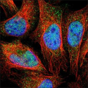 Anti-BTG1 antibody produced in rabbit HPA005972-100UL