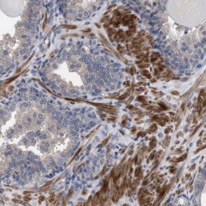 Anti-BTN2A1 antibody produced in rabbit 