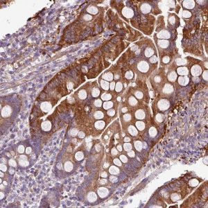 Anti-BTN2A2 antibody produced in rabbit 