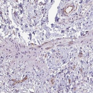 Anti-C10orf10 antibody produced in rabbit 