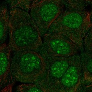 Anti-C10orf67 antibody produced in rabbit 