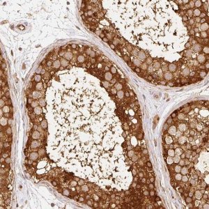 Anti-C10orf76 antibody produced in rabbit 