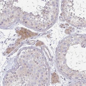 Anti-C10orf90 antibody produced in rabbit 