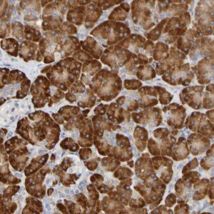 Anti-C11orf24 antibody produced in rabbit 