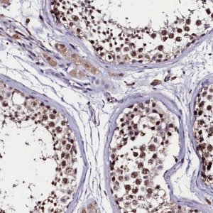 Anti-C11orf49 antibody produced in rabbit 