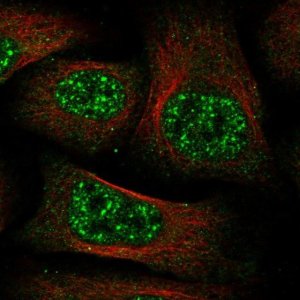 Anti-C11orf49 antibody produced in rabbit 