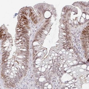 Anti-C11orf53 antibody produced in rabbit 