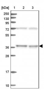 Anti-C11orf54 antibody produced in rabbit 
