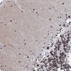 Anti-C11orf57 antibody produced in rabbit 