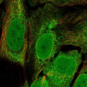 Anti-C11orf58 antibody produced in rabbit 