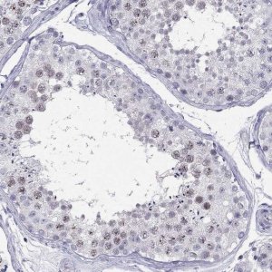 Anti-C11orf63 antibody produced in rabbit 